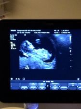 Second Ultrasound, 1/6/14
